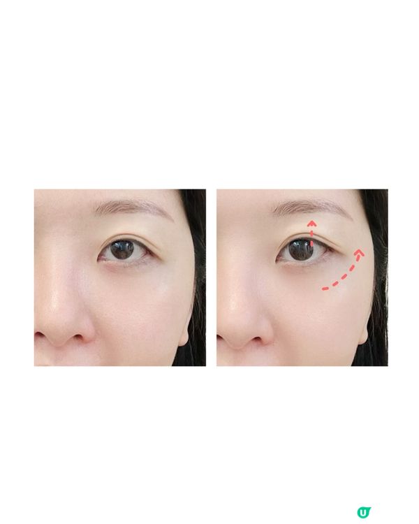 Emayplus睛靈棒解決眼紋、黑眼圈問題