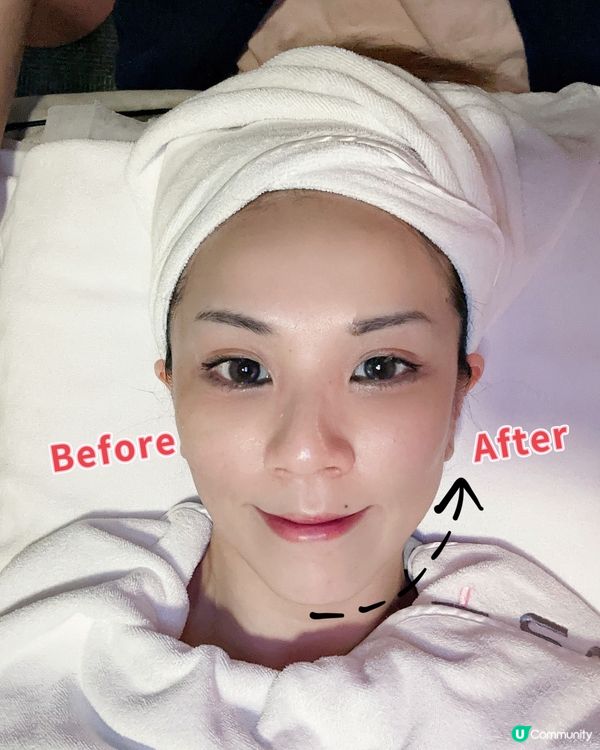 星座護膚 x 冷熱交感射頻 ♥ 重現緊緻V面！►CG星辰Glow Up療程