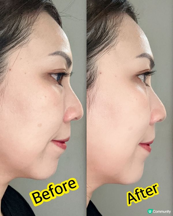 【限時團購】居家美肌之選 ♥ 14天透亮牛奶肌！ ►Ulike超光炮Pro美容儀