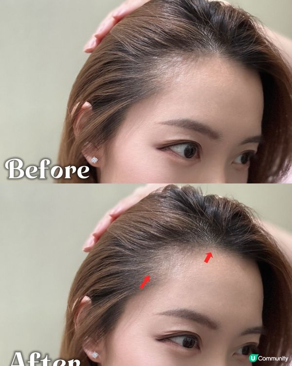 脫髮救星 ❤️‍🔥✨