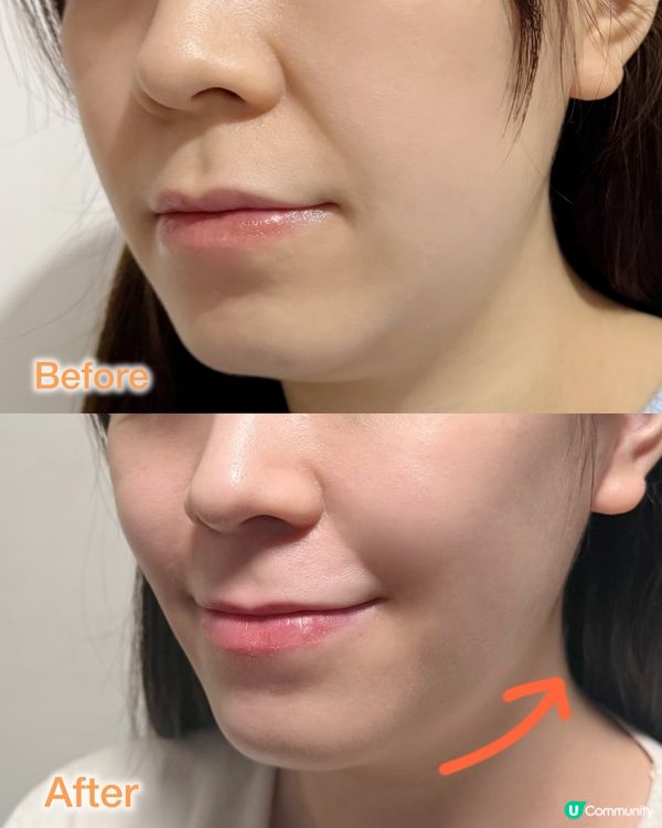 ✨逆齡好物！💖Meditherpy粉光逆齡彈性精華💓