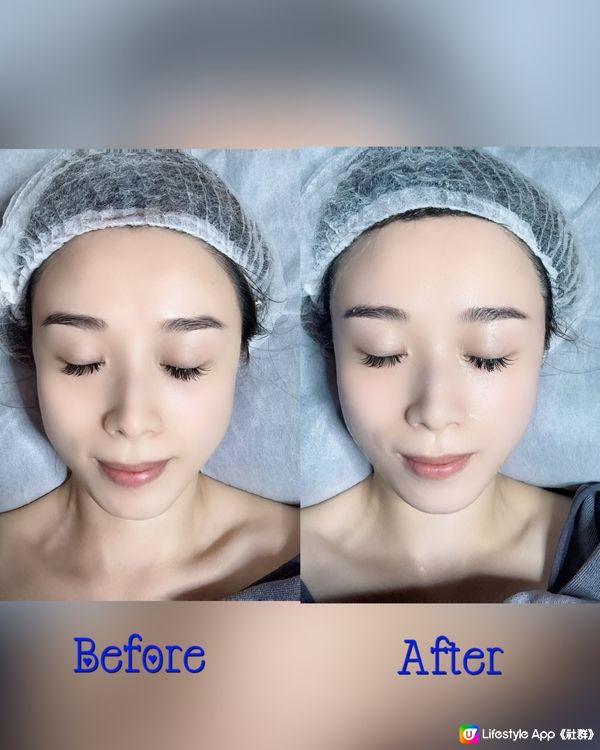 𝐁𝐞𝐚𝐮𝐭𝐲 𝐀𝐥𝐥𝐮𝐫𝐞✨主打人手facial🙌🏻