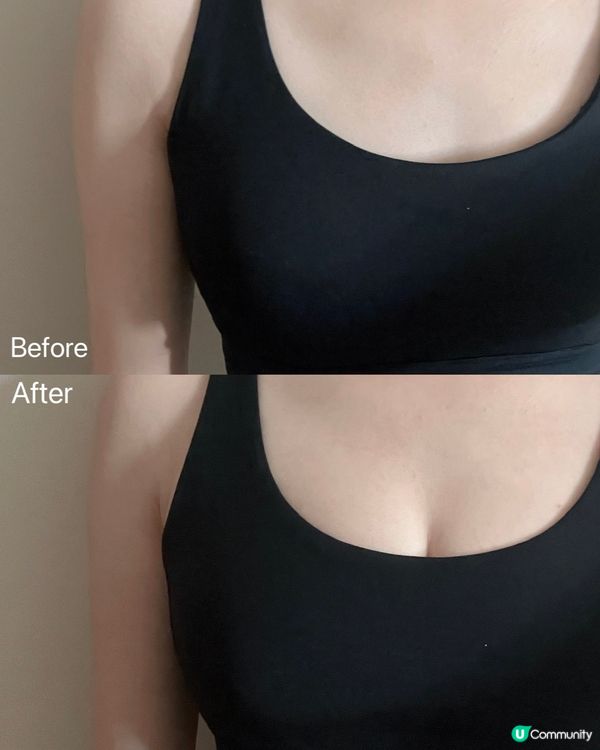 30天找回「少女胸」！不手術不吞藥