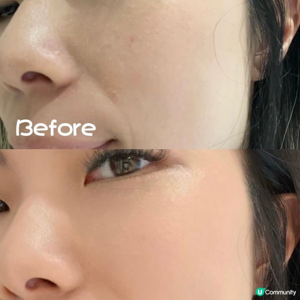 爛面救星！🔥醫美界爆紅精華，急救敏感肌！😱