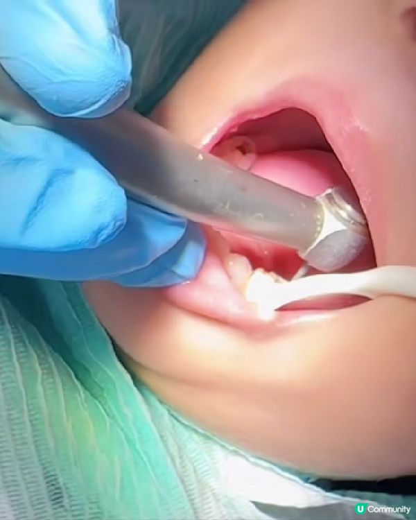 港車北上深圳睇牙