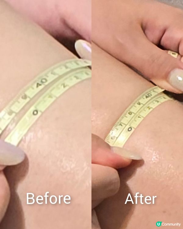 ✨1+1= -1?✨美容水刮+外用祛濕搽=減水腫1cm*！