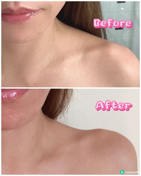 改善肩頸線條同時輕鬆告別斑點✨