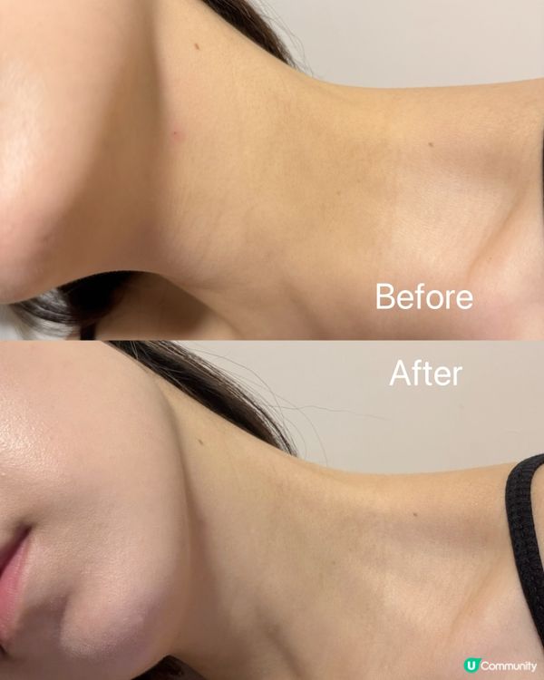 頸紋走晒！韓國神級保養🤩 頸膜推介！