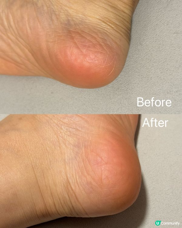 頸紋走晒！韓國神級保養🤩 頸膜推介！