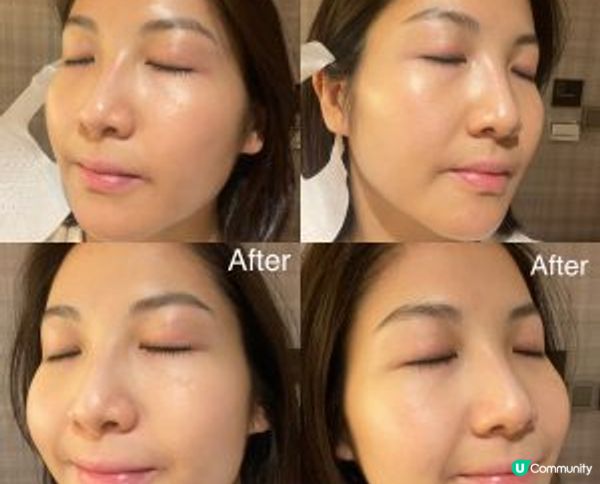 凱詩美容「LDM®細胞肌膚美學皇牌療程」