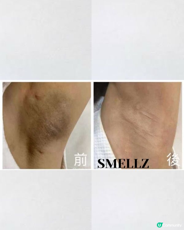 《試後感》狐香公主Smellz好唔好？改善臭狐|產後腋下色素