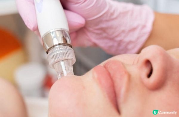 75分鐘時間速效急救爛面 一次過解決暗粒、毛孔、甩皮皮膚問題