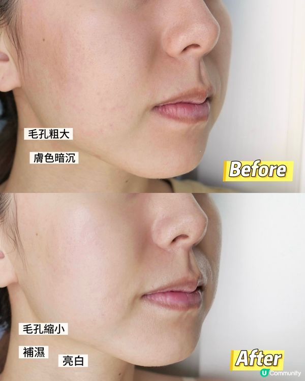 Saiseico 黑白面膜 轉季救星！5日逆轉肌齡✨