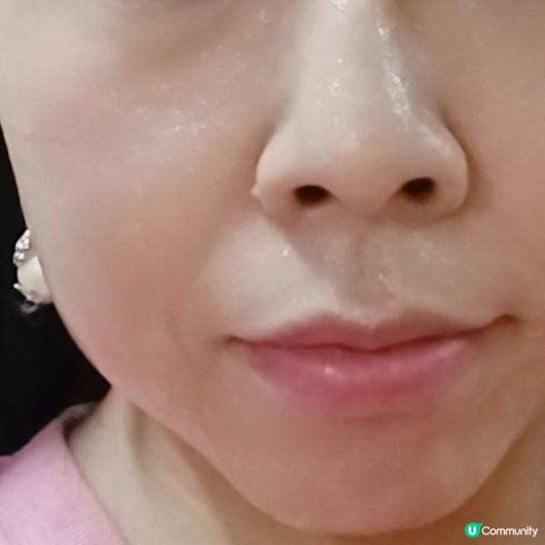 玻尿酸啫喱面膜🤩！急救保濕一流！💧