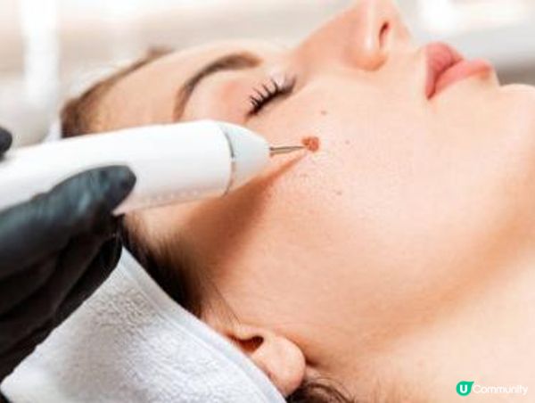 香港黃金微針術後保養全攻略，這些細節問題需要注意