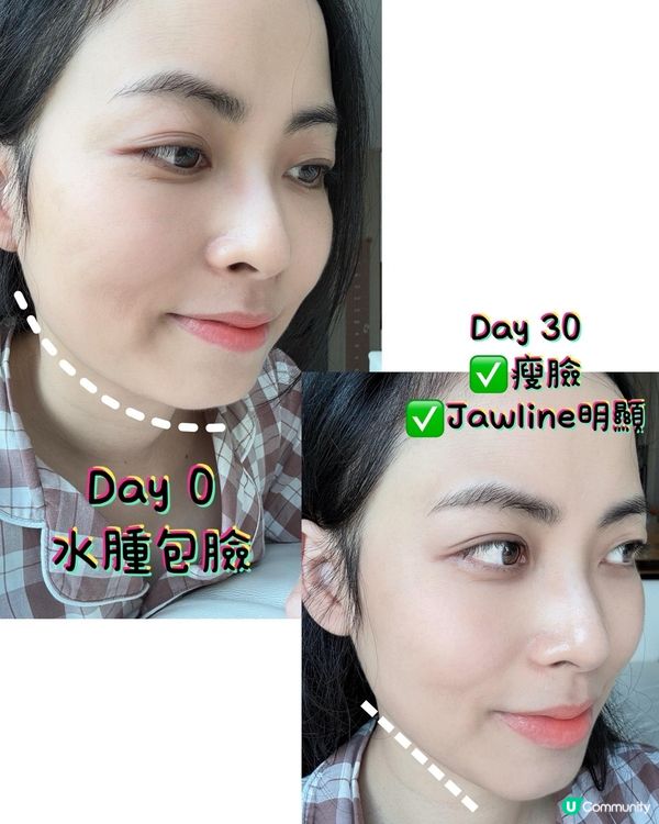 實測｜中醫調配內外袪濕毒組合：健之堂祛濕王+祛濕茯苓艾草足貼