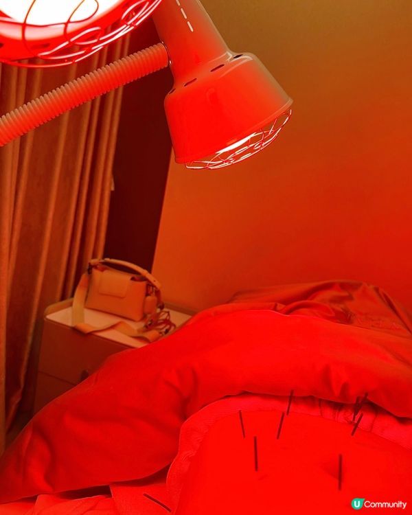 中醫美顏針初體驗，一次即見效果超神⚡️入黎攞優惠一齊靚