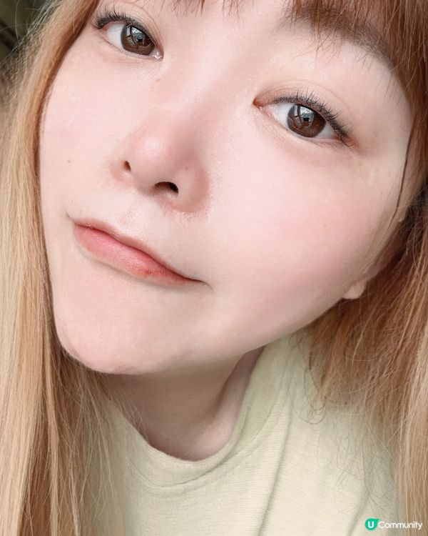 中醫美顏針初體驗，一次即見效果超神⚡️入黎攞優惠一齊靚