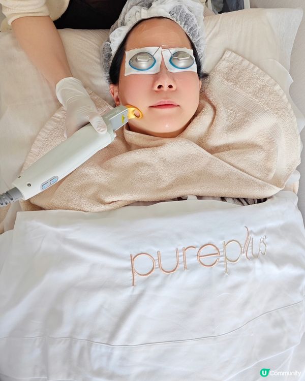 excel VTM 退紅激光療程