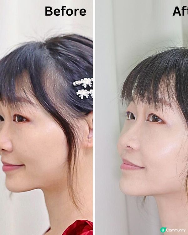 睡眠質素差有幾百樣害處 其中一樣就係皮膚差