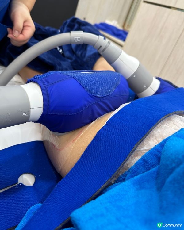 夏日去除脂肪最快方法 