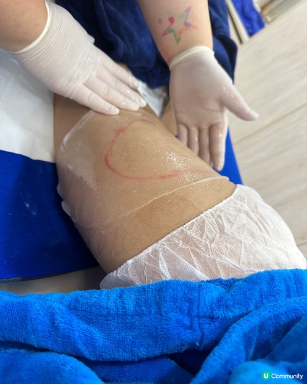 夏日去除脂肪最快方法 