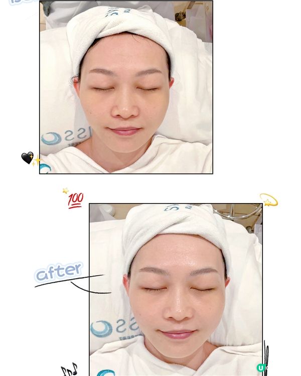 傳統人手Facial有咩好？