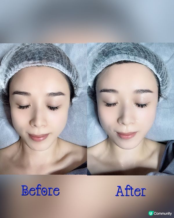 𝐁𝐞𝐚𝐮𝐭𝐲 𝐀𝐥𝐥𝐮𝐫𝐞✨主打人手facial🙌🏻