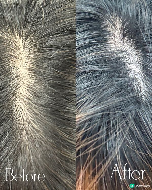 實測TALIKA HAIR FORCE防脫髮系列！