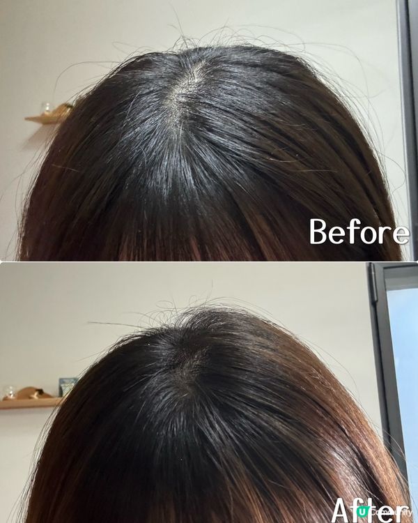 【護髮】法國品牌防脫髮精華光學導入儀套裝