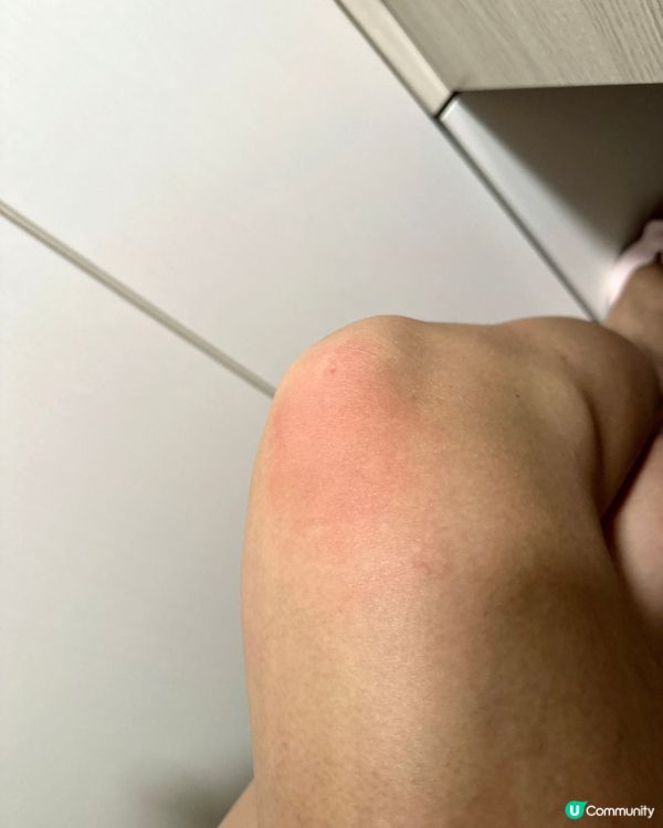 皮膚敏感用咩好？