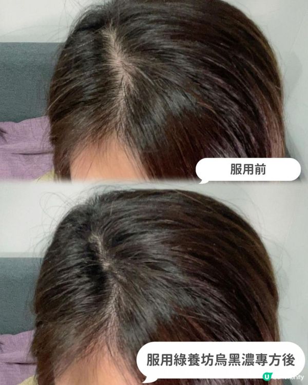 ｛防脫髮還是相信內服最有效！｝