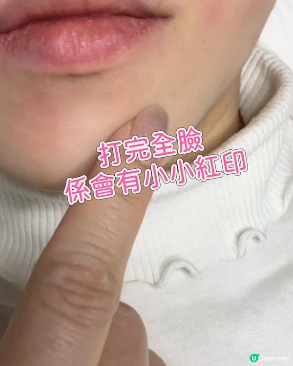 打走微絲血管💯一次搞點🩷