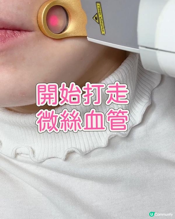 打走微絲血管💯一次搞點🩷