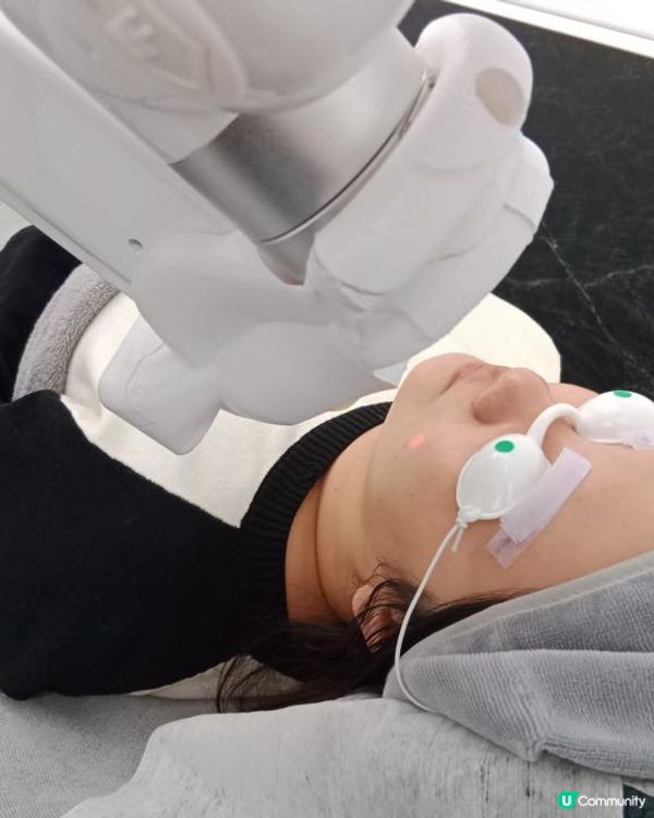 AI 驅動機器人激光嫩膚機