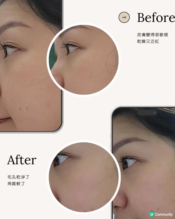 積雪草舒緩平衡凍膜