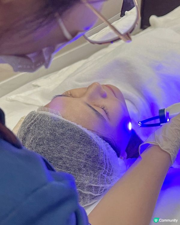 【護膚心得】CAPRI藍激光療程 痘痘清晒