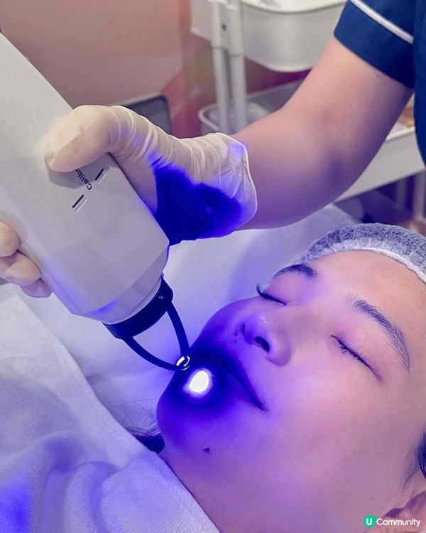 【護膚心得】CAPRI藍激光療程 痘痘清晒