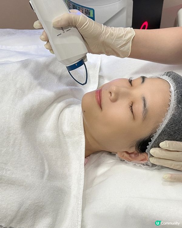 【護膚心得】CAPRI藍激光療程 痘痘清晒