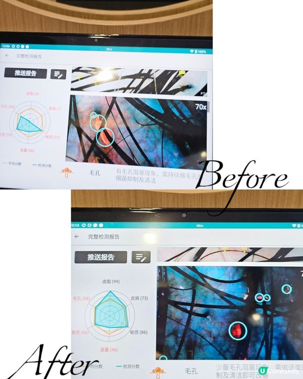 📍深圳必去。女神偏愛。養髮安神～頭道湯💆🏻‍♀️ 