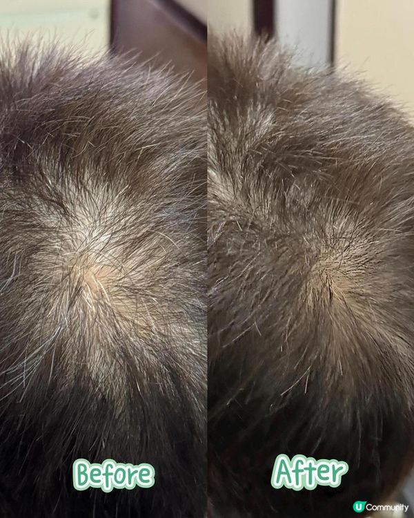 『男士烏黑濃髮靠曬佢！』