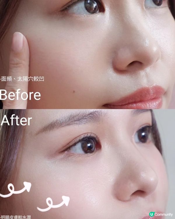 LE MOI-PEAU肌我⭐可以提供迷人嘅脂肪填充？