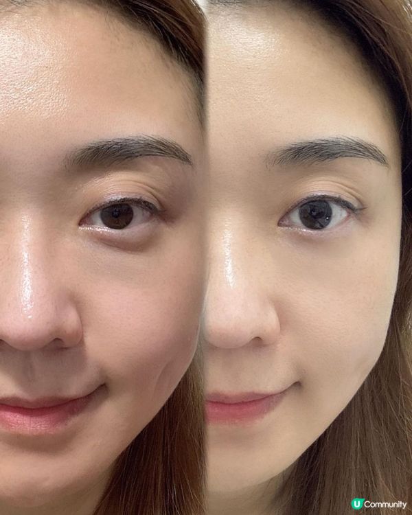 EMAY PLUS 睛靈棒【提升眼肌】對抗初老鬆弛眼肌有辦法