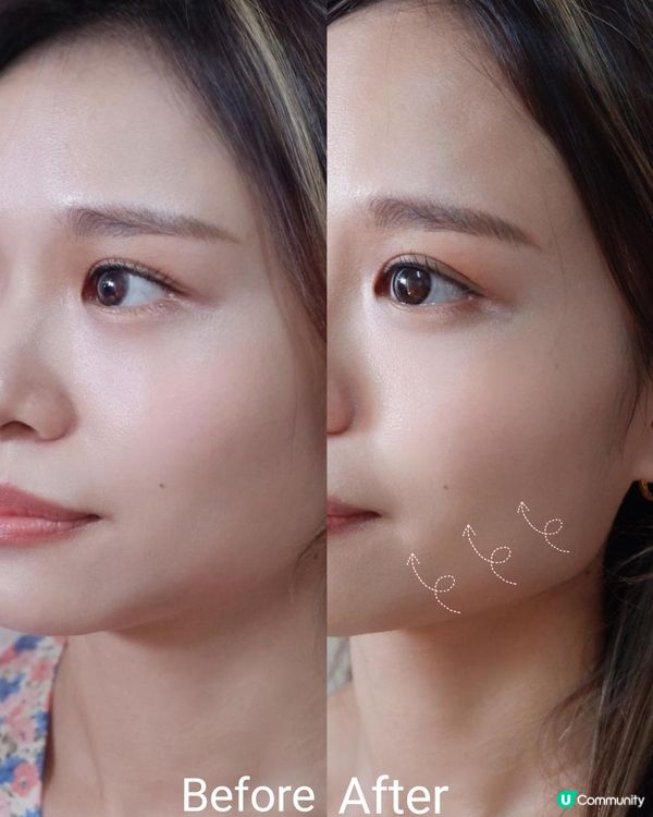 世界上唯一家用臨床級納米電流美容儀⭐係咪真係work?