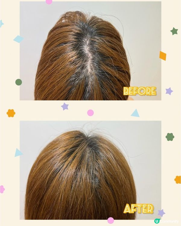 開始有脫髮問題點算好？