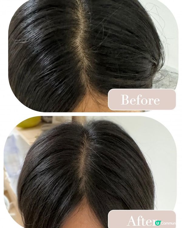 產後脫髮改善方法🙌🏻