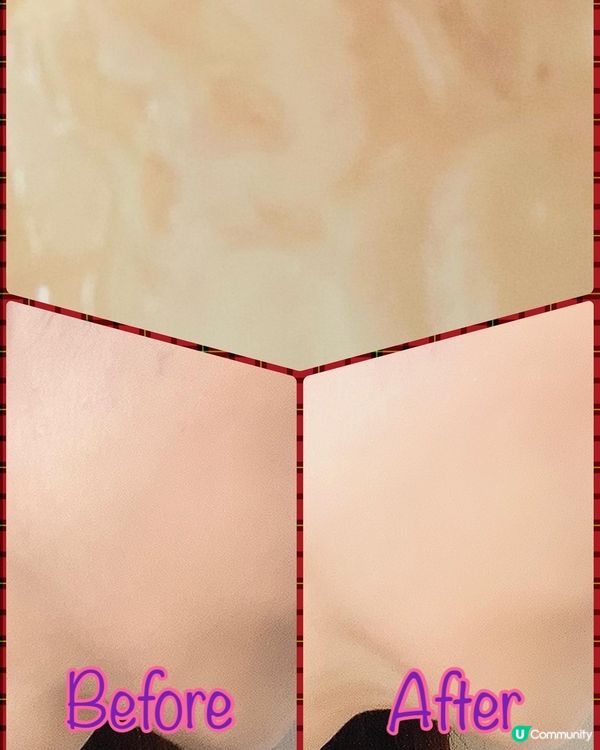 出現細紋怎麼辦？