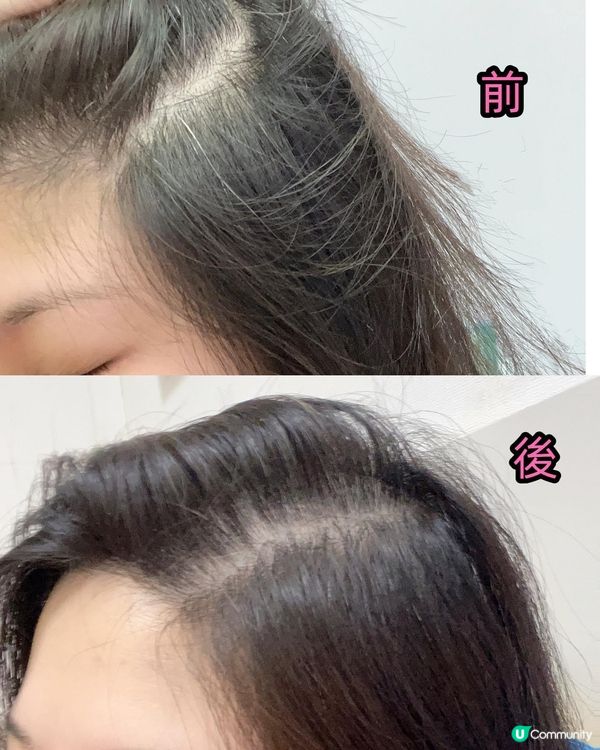 🌿升級黑髪激活精華