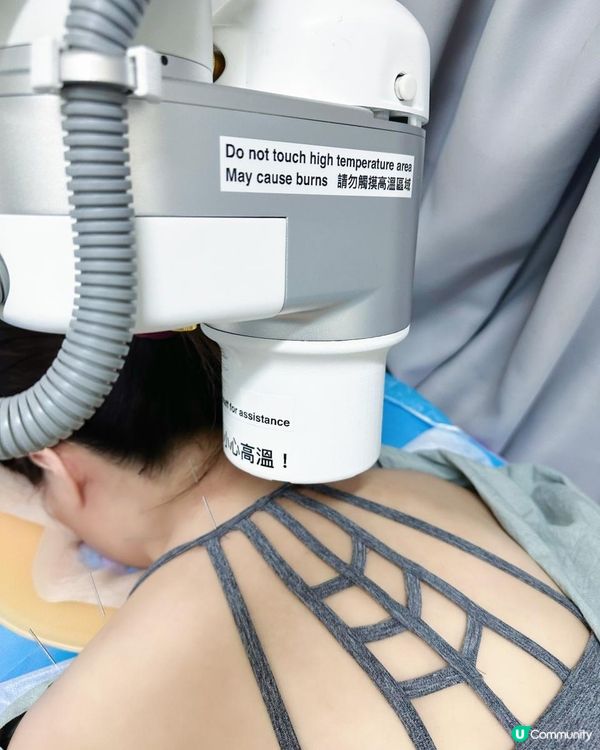 高科技中醫遙遙領先, 話你知養康中醫館AI艾灸機器人好唔好? 