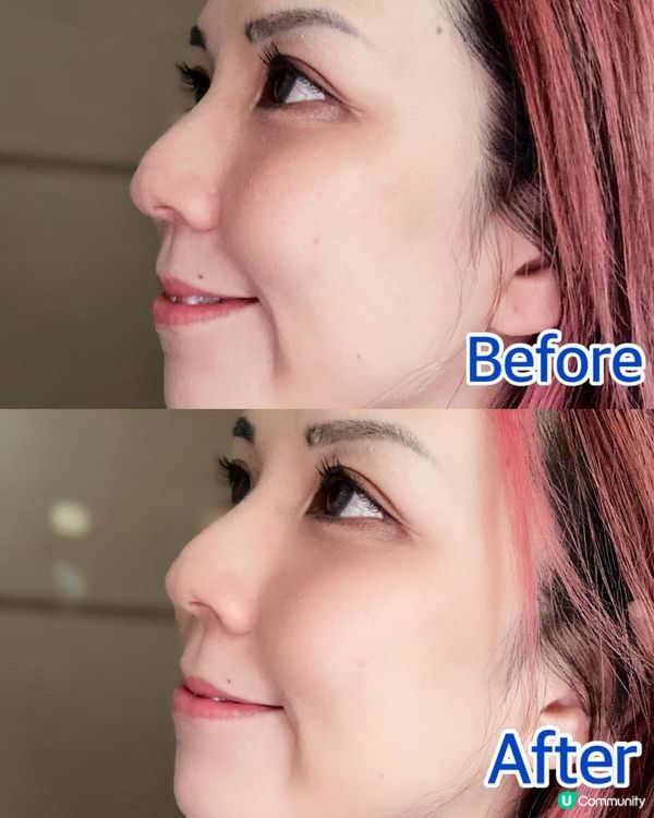 5.24萬寧出位價 ♥ 敏感肌夏日必備之選！►gülsha 1+1日夜玫瑰精華油